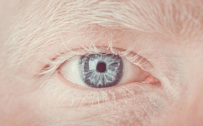 Цвет глаз: как он формируется и почему изменяется